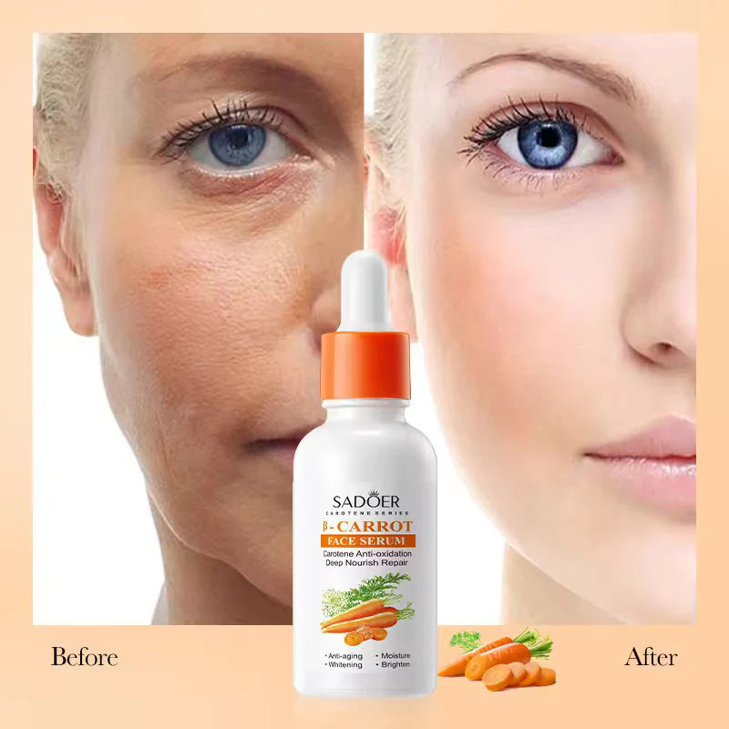 SADOER Carotene Soothing And Repairing B-Carrot Face Serum - 30ml