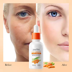 SADOER Carotene Soothing And Repairing B-Carrot Face Serum - 30ml