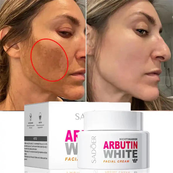 Sadoer Nicotinamide Arbutin White Facial Cream - 50g