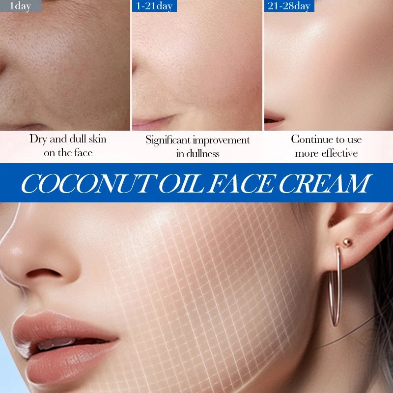 SADOER Nourishing Coconut Oil Moisturizing Face Cream  - 50gm