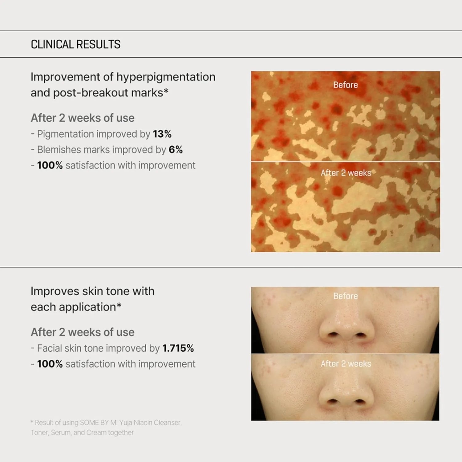 SOME BY MI Yuja Niacin Anti Blemish Cream - 60ml