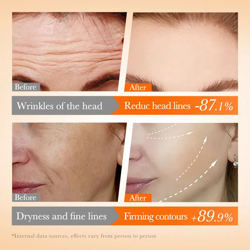 Sadoer Multi-Peptide Collagen Vitamin C Nourishing Skin Care Set