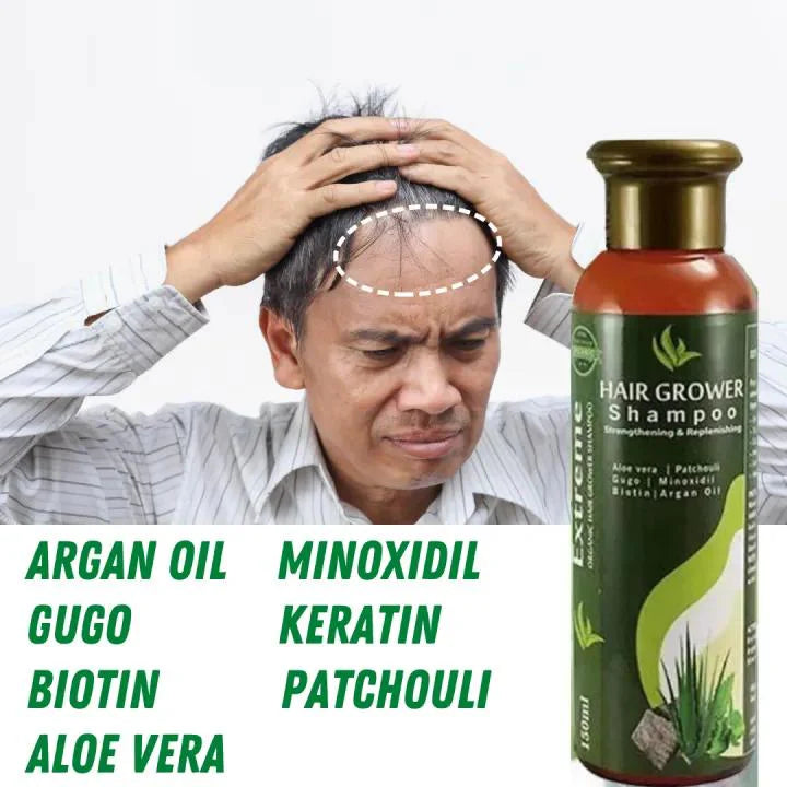 Sunisa Aloe Vera Hair Growth Shampoo - 150ml