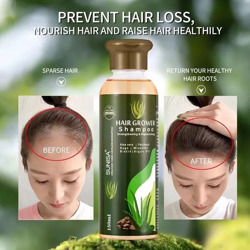 Sunisa Aloe Vera Hair Growth Shampoo - 150ml