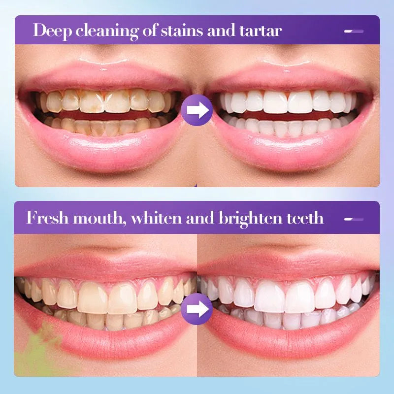 Sadoer V34 Remove Yellow Teeth Stains Whitening Toothpaste – 28 ml