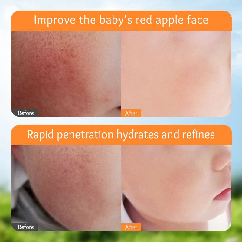 Sadoer Calendula Amino Acid Formula Baby Moist Cream – 50 g