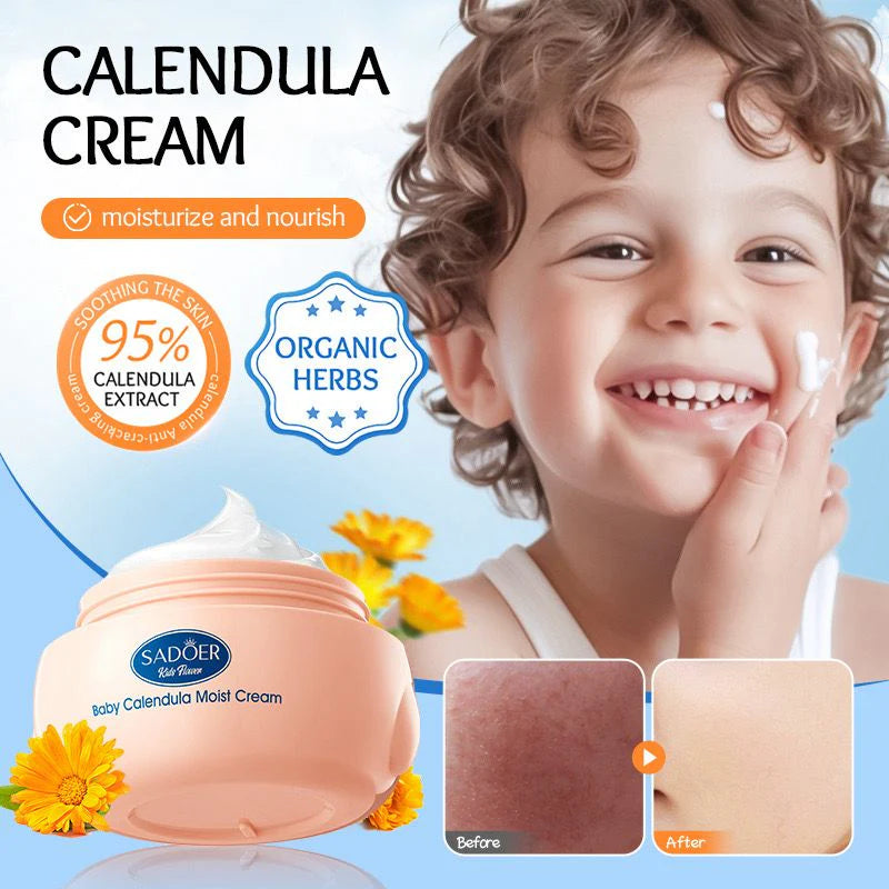 Sadoer Calendula Amino Acid Formula Baby Moist Cream – 50 g