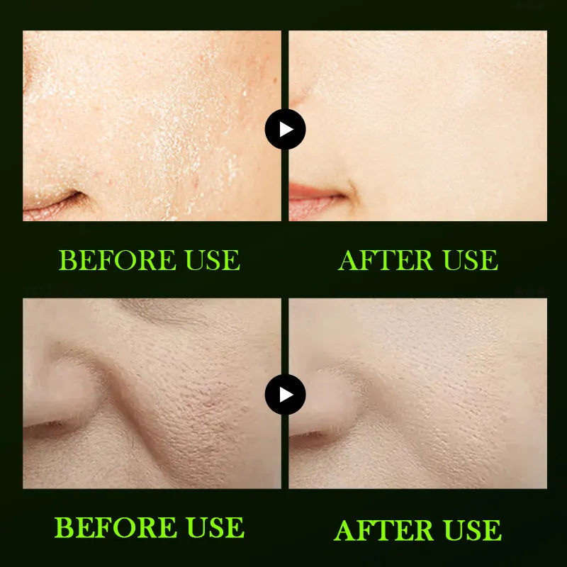 ZOZU Natural Olive Oil Soothing and Repairing Facial Serum 30ml