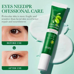 ZOZU Olive Oil Eye Cream Remove Dark Circles Reduce Fine Lines And Moisturizing Eye Cream 20g