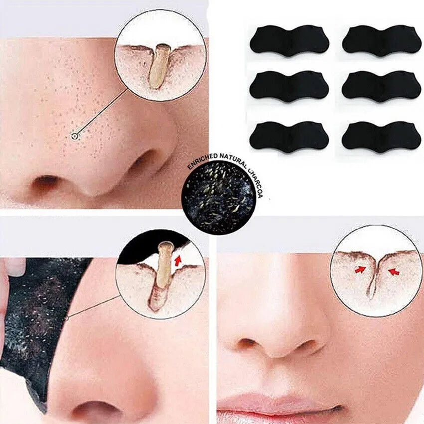 Sadoer 10pcs Nose Blackhead Remover Strips Mask