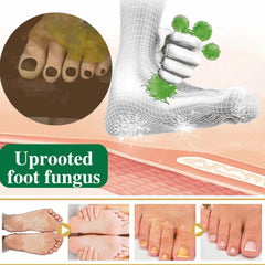 Athlete's Foot Herbal Antibacterial Spray