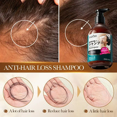 SADOER Anti Hair Loss Shampoo Anti-dandruff Hair Growth Shampoo - 300ml