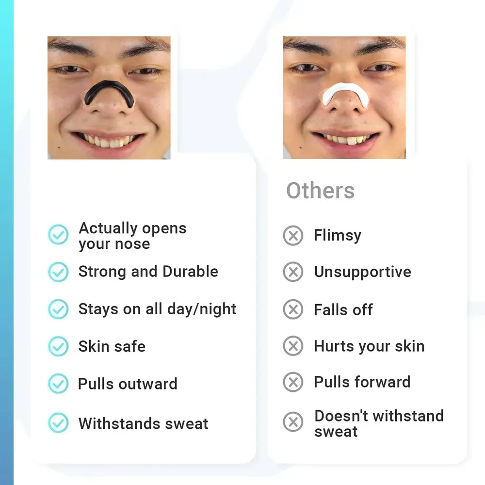 Sleepco Nasal Dilator Starter Kit. 4 Sizes