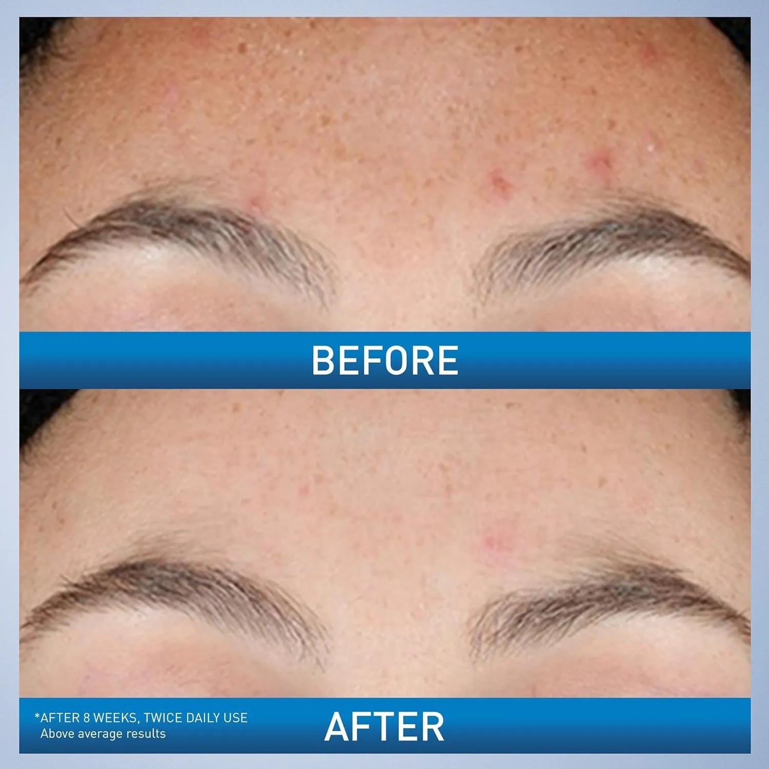 CeraVe Resurfacing Retinol Serum – 30ml