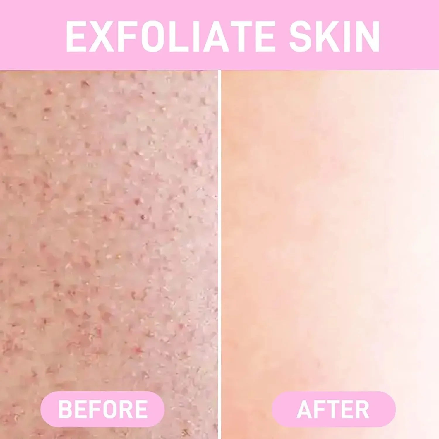 hair removal Crystal - 100% Original