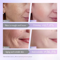 Bioaqua Hyaluronic Acid + Vitamin A Firming Repairing Essence Facial Mask - Each