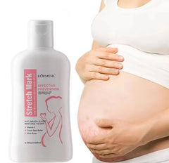 KORMESIC Stretch Mark Care Lotion – 200ml