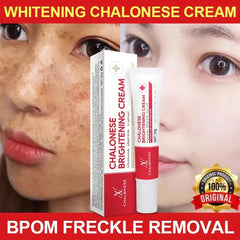 CHALONESE Brightening Cream Serum – 20g