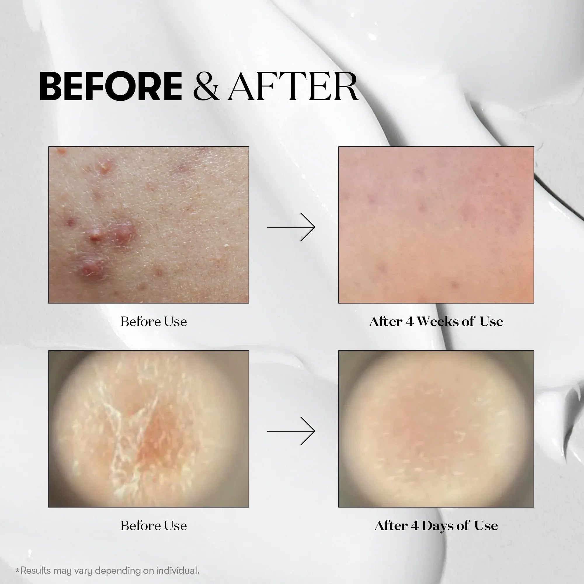 Reedle Shot 100 Esseence Revitalizing & Youth - 50ml