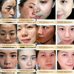CHALONESE Brightening Cream Serum – 20g