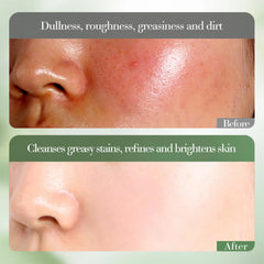 SADOER Vitamin C Whitening Amino Acid Gentle Cleanser- 150g