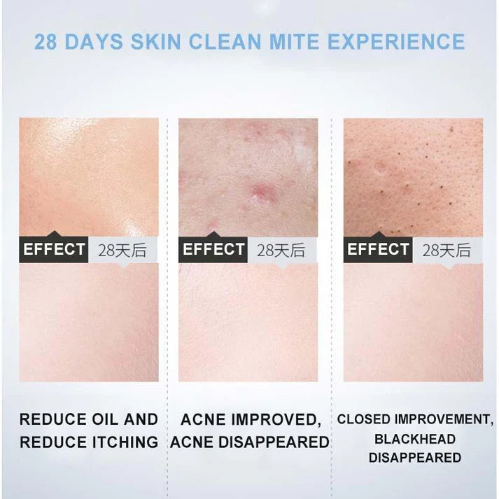 Dr.Rashel Hyaluronic Acid Essence Cleansing Mousse - 120ml