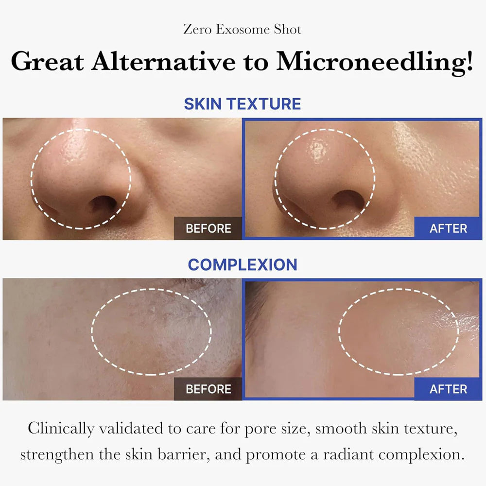 Medicube One Day Exosome Shot 7500 - 30ml