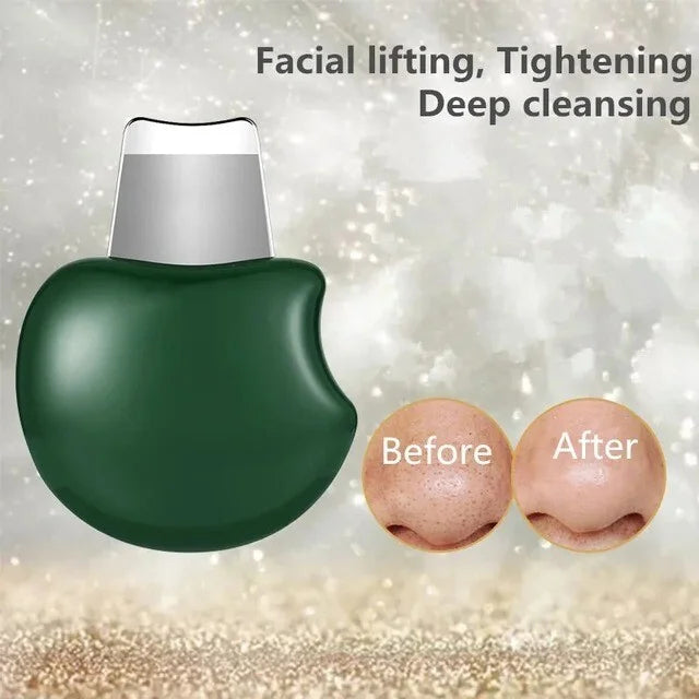 Portable Manual Blackhead Remover Tool for Facial Skincare, Pore Cleaning and Tightening